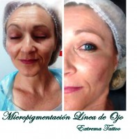 /album/micropigmentacion/micropigmentacion-badajoz-v-jpg/